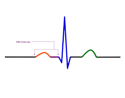 Image result for PR Interval