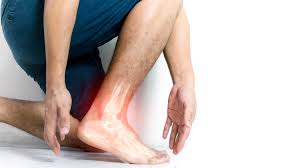 Image result for Leg Pain