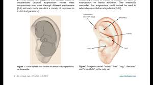 Pin On Acupuncture Does It Really Work