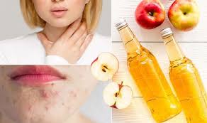 Apple cider vinegar has become one of the darlings of natural skincare. Apple Cider Vinegar Benefits Five Ways Apple Cider Vinegar Could Improve Your Health Express Co Uk