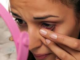 Update your find a dermatologist profile, the academy's directory that's visited by over 1 million people a year. Skin Tags On Eyelids Causes And How To Remove Them