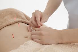 Here S How Acupuncture Can Help You Lose Weight Shape Singapore