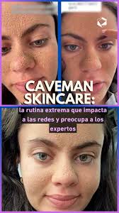 Caveman Skincare: la rutina extrema que impacta a las redes y preocupa a  los expertos