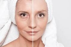 Image result for what is radio frequency treatment for face