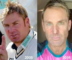 Shane Warne's Changing Face