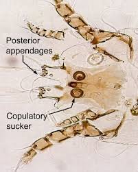 Image result for Pseudoprosopis