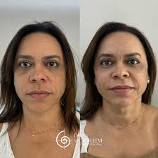 𝗗𝗿. 𝗩𝗶𝗰𝘁𝗼𝗿 𝗟𝗲𝘃𝗶