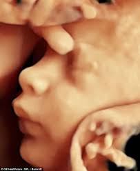 Hello Baby Incredible 3d Scans Allow Parents To See Foetus Smiling And Moving In Stunning Detail 3d Ultrasound Ultrasound Reveal Ultrasound Pictures