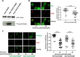 Molecular subversion of cdc42 signalling in cancer. A Toxic Palmitoylation On Cdc42 Drives A Severe Autoinflammatory Syndrome Biorxiv