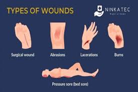 Image result for Wound