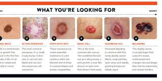It affects people of all races, genders and ages, which is why it's absolutely critical for americans to learn about. We Re In Trouble Skin Cancer Is On The Rise And Not Just For Golfers Golf Digest