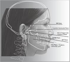 Image result for Occlusal