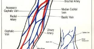 Iv Placement Chart Related Keywords Suggestions Iv