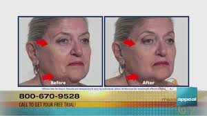 Mass Appeal Special Valentine's Day offer from Plexaderm!