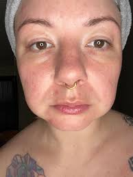 Nina Pools Tucks for your under eyes hack works!!!