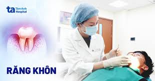 Răng khôn là gì? Có mấy cái? Vị trí mọc thường ở đâu?