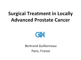 Learn more about the symptoms and signs of advanced prostate cancer and when you should call your doctor. Surgical Treatment In Locally Advanced Prostate Cancer Ppt Download