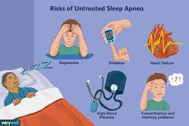 Image result for Sleep Apnea