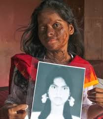 Facebook le dă oamenilor puterea de a comunica şi face lumea mai. Bangladeshi Acid Attack Victim Hasina Akter Finds Empowerment Faces The Man Who Disfigured Her Mama Asia Abc News