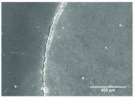 Download for free or view this ibond self etch user manual manual online on onlinefreeguides.com. Sem Micrograph Of Non Continuous Margin Group 1 Ibond Self Etch Download Scientific Diagram