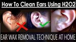 Found On Google From Youtube Com Ear Wax Removal Ear Cleaning Ear Wax