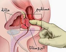 التهاب البروستات المزمن يؤثر سلبا على الصحة الإنجابية للرجال. Ø¹Ø¨ÙˆØ³ ØªØ­Ø¬Ø± ØªØ®ØªÙÙŠ ØªØ¶Ø®Ù… Ø§Ù„Ø¨Ø±ÙˆØ³ØªØ§ØªØ§ ÙÙŠ Ø§Ù„Ø±Ø¬Ø§Ù„ Comertinsaat Com