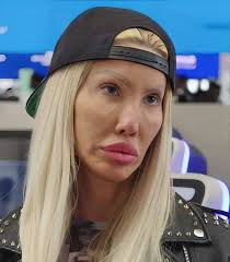 What do you think about Nikki's strong man features after surgeries?