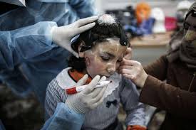 نساء غزة يترددن على مراكز التجميل في القاهرة.. لإزالة تشوهات الحرب! | وكالة  شهاب الإخبارية
