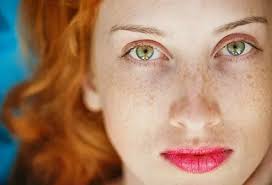 Image result for Freckled skin