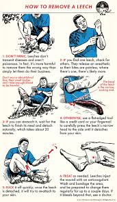 How to Remove a Leech | The Art of Manliness