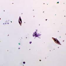 In simple one celled organisms such as amoeba phagocytosis is a feeding mechanism. Mixed Protozoa W M Microscope Slide Microscope Sample Slides Amazon Com Industrial Scientific