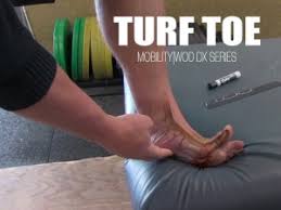 Even though it is not considered a serious injury it can be very debilitating and take a long time to heal. Turf Toe Archives Trs Members