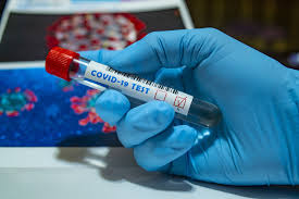Also like a pcr test, the process looks for genetic material from the coronavirus, amplifying it and measuring it. Sp Esta Fazendo 8 000 Testes Para Diagnostico De Covid 19 Por Dia Veja Sao Paulo