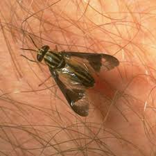 Bug Bite With Black And Blue Ring Around It Deer Fly Control Deterrent Tips To Keep Biting Flies Away Deer Fly Fly Repellant For Dogs Simple Tricks
