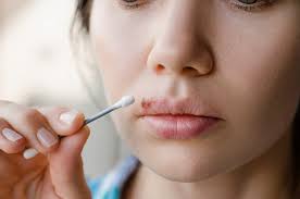 Dabei handelt es sich um eine höchst ansteckende erkrankung, die leicht auf andere personen übertragen werden kann. Therapie Und Hygiene Finger Weg Vom Lippenherpes Pz Pharmazeutische Zeitung