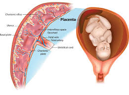 Image result for Retained Placenta