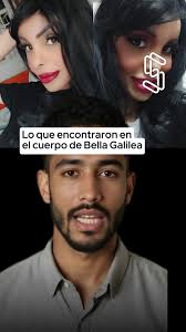 Paralisis Facial Vanessa 4k