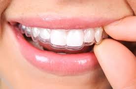 Not Happy With Your Smile In 2020 Teeth Straightening Invisalign Invisalign Dentist