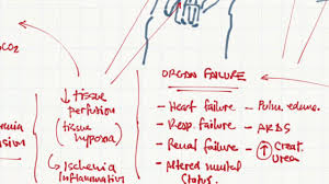 Check spelling or type a new query. Fiebre Y Sepsis Parte 2 Fisiopatologia Y Shock Septico Youtube