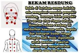Umumnya, individu yang tidak digalakkan untuk berbekam ialah wanita mengandung, wanita haid, wanita yang kerap keguguran, individu yang terlalu lemah, orang tua uzur, pengidap kanser darah, pengidap tekanan darah rendah serius dan pengidap penyakit kulit serius. Kebaikan Bekam Kosmetik Bekam Seri Urutan Shohwatul Facebook