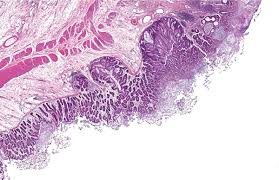 Image result for Shigella