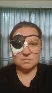 Wear eye protection around chickens to avoid injury