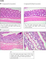 Chemopreventive Effects Of Curcumin Analogs In Dmh Induced Colon Cancer In Albino Rats Model Sciencedirect