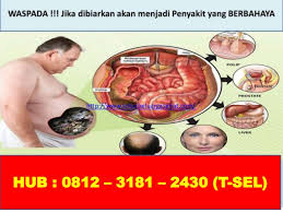 Propa padahal mudah kalu rajin. Cara Membersihkan Usus Besar Secara Alami