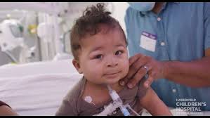 The EXIT Procedure: Experience and Outcomes