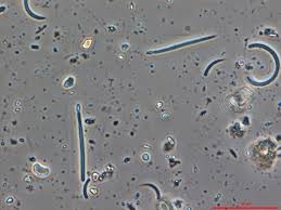 Image result for Cylindropsis