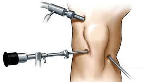 مراقبت‌های قبل و بعد از آرتروسکوپی زانو - جراح ارتوپد و فوق تخصص زانو -  دکتر قماشی