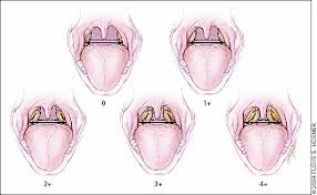 Obstructive Sleep Apnea In Children American Family Physician