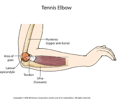 Psychology Physio Blog Tennis Elbow And Exercise Protocol