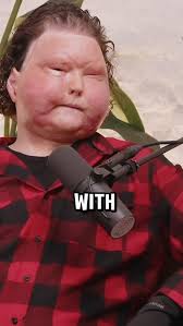 Please consider supporting Joe